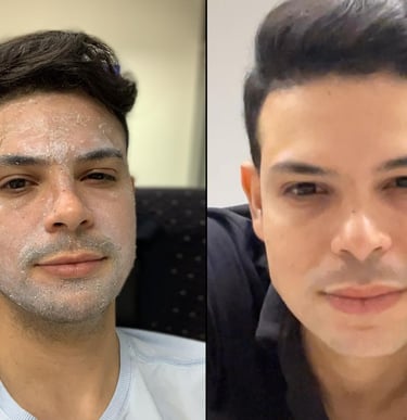 Qualidade da Pele
